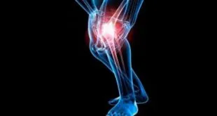 LAS RODILLAS Y EL CONFLICTO EMOCIONAL 2026 dolor de rodilla emocional