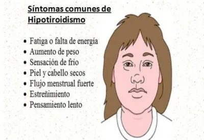 hipotiroidismo