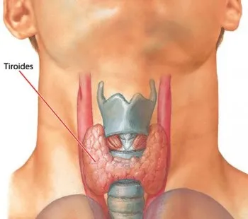 tiroides