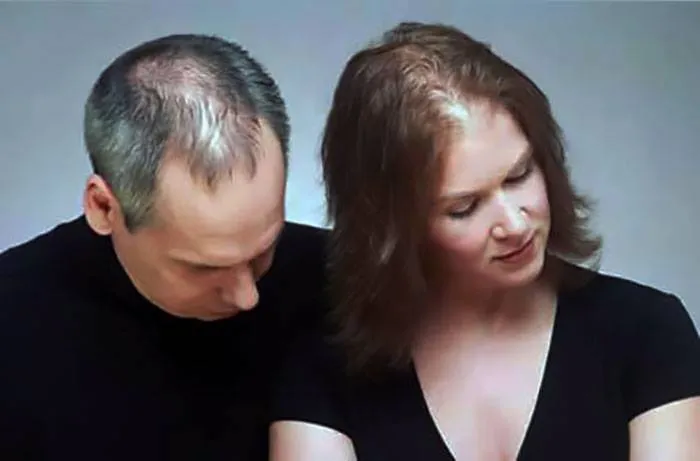 EL CABELLO Y SUS CONFLICTOS EMOCIONALES